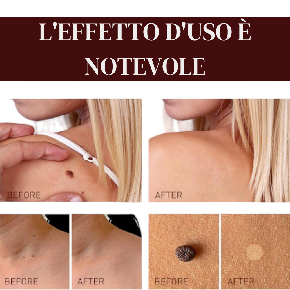 Aggiungi-un-titolo-1.png Aggiungi-un-titolo-1.png